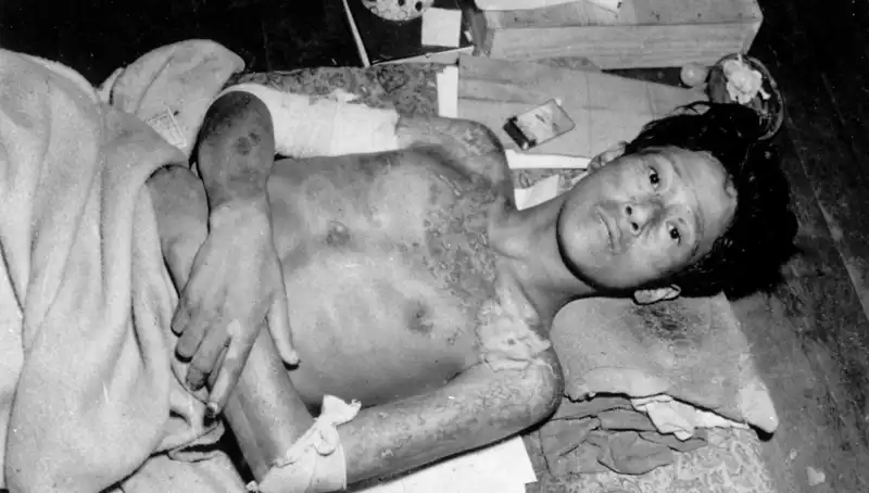 80 Yıl Sonra Nagasaki’den Endişe Verici Çağrı: Nükleer Tehlike Yeniden Gündemde