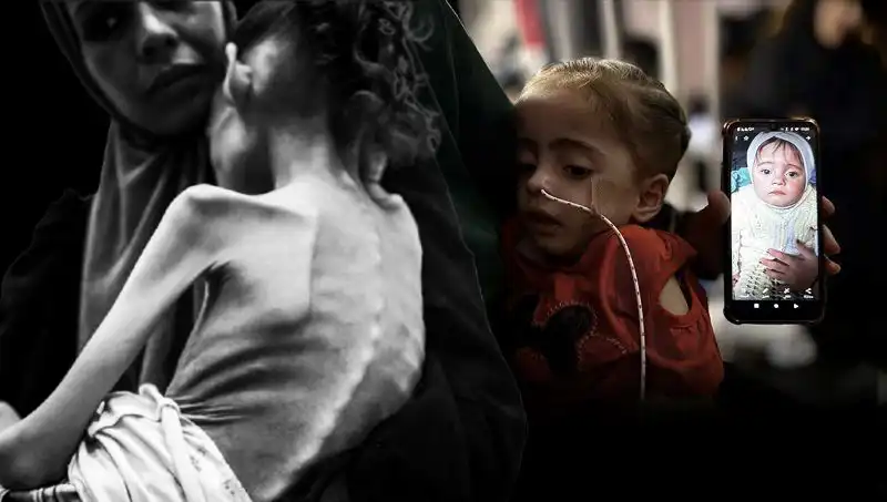 Meryem'in Zorlu Mücadelesi: 25 Kilodan 10 Kiloya Düşen Minik Kızımız